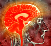 Radiographie du cerveau de profil